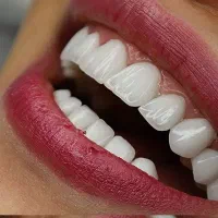 کامپوزیتcipلبه شیشه ای 12الی20