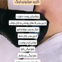 آموزش تخصصی پاکسازی و فیشال پوست با دستگاه با مدرک|خدمات آموزشی|شاهینشهر, عطار|دیوار