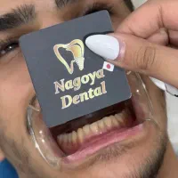 کامپوزیت/لمینیت/قسطی/دندان/پالیش کامپوزیت