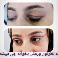 جشنواره جراحی بینی|خدمات آرایشگری و زیبایی|سقز, |دیوار