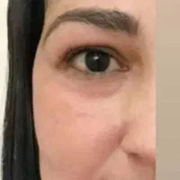 محصولات مراقبتی وبهداشتی پوست ومو|آرایشی، بهداشتی، درمانی|اهرم, |دیوار