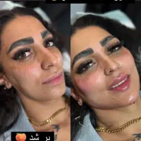 فیلر ژل بوتاکس مزو لیزر هایفو فول فیس ۵۰٪ آف|خدمات آرایشگری و زیبایی|مشهد, فرهنگ|دیوار