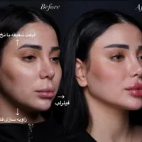 زیبایی حق شماست به خودتون هدیه بدید|خدمات آرایشگری و زیبایی|رشت, گلسار|دیوار