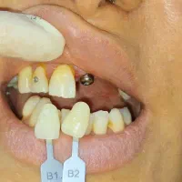 دستیار دندانپزشک