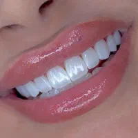 لبخند زیبا با شرایط پرداخت آسان