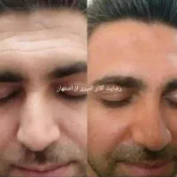 کرم معجزه اصل آلمانی ، ایتالیایی با بهترین مواد|آرایشی، بهداشتی، درمانی|لردگان, |دیوار