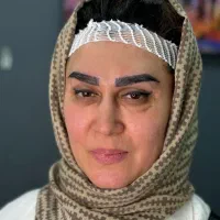 کاشت ابرو وموcip دربیمارستان ضمانتدار ۱۲ تومن