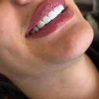 کامپوزیت خرم اباد