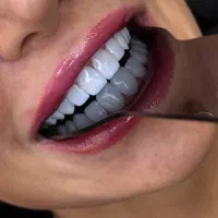 زیبایی و سلامت دهان و دندان