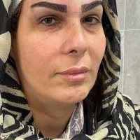 کاشت ابروی مادام العمر در کلینیک تخصصی پوست و مو|خدمات آرایشگری و زیبایی|فولادشهر, C5|دیوار