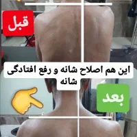 رگگیری.اصلاحی.زالودرمانی.حجامت.اصلاحی