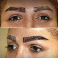 کاشت مو ابرو ریش بدون جراحی ضمانتنامه مادام العمر|خدمات آرایشگری و زیبایی|تهران, الهیه|دیوار