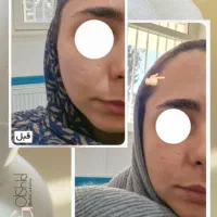 متخصص پوست و موهمراه مشاوره‌  وروتین پیشنهاد محصول|خدمات آرایشگری و زیبایی|اردبیل, |دیوار