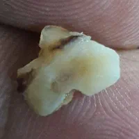 فروش  ۲۰۰ گرم نقره