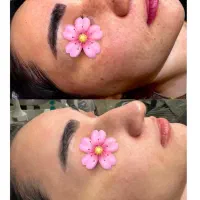 لیزر موهای زائد فول بادی ۴۹۰ تومان|خدمات آرایشگری و زیبایی|رشت, گلسار|دیوار