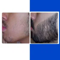 رشد ریش و سبیل
