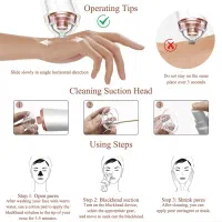 میکرودرم پوست لوویکا مدل X1003|آرایشگاه و سالن‌های زیبایی|تهران, علم و صنعت|دیوار