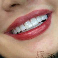 کامپوزیت ارزان