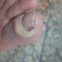 خدمات پرستاری پزشکی پانسمان تزریقات|پزشکی|اهواز, گلستان|دیوار