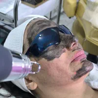 لیزر و زیبایی ونوس زیر نظر پزشک