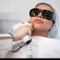 لیزر موهای زائد بانوان لیزر کندلا لیزر شاتی مشهد