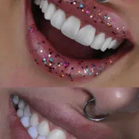 لبخند هالیوودی دندان بدون دردوتخفیف واقعی شب یلدا