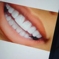 کار اموز خانم دندانسازی