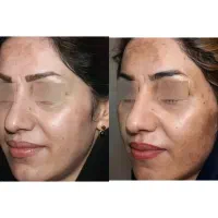 درمان تمام بیماریها