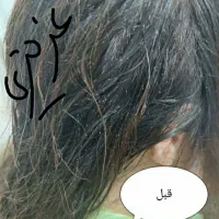 درمان صدرصدقطعی وتضمینی شپش ورشک|آرایشی، بهداشتی، درمانی|نورآباد, |دیوار