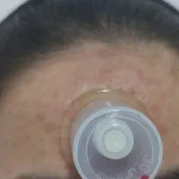 حجامت.زالو.نیدل لاغری.بواسیر.یون تراپی یا سم زدایی|خدمات آرایشگری و زیبایی|مشهد, توس (بلوار توس)|دیوار
