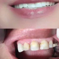 خدمات دندانپزشکی|خدمات آرایشگری و زیبایی|یاسوج, |دیوار