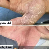 اصلاح مزاج و پاکسازی