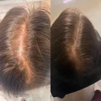 تونیک تقویت کننده مو ۳۰۰ میل|آرایشی، بهداشتی، درمانی|برازجان, |دیوار