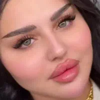 خدمات ژل و بوتاکس