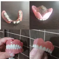 چی بود و چی شد دندان مصنوعی|فعالیت داوطلبانه|ایجرود, |دیوار