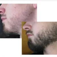 تو ۱۸ روز مشکلت و حل میکنم
