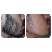 تغییر کن|آرایشی، بهداشتی، درمانی|تکاب, |دیوار