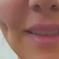 یلدایی چالگونه دائم با بخیه و انواع پیرسینگ|خدمات آرایشگری و زیبایی|گرگان, |دیوار