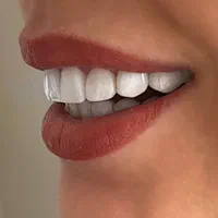 خدمات دندانپزشکی با پرداخت بلندمدت