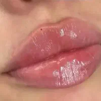 تزریق فیلر و بوتاکس با کیفیت عالی و قیمت مناسب