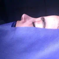 جشنواره عمل بینی،تیپ،جراحی بینی،21میلیون تومان|خدمات آرایشگری و زیبایی|مشهد, سجاد شهر|دیوار
