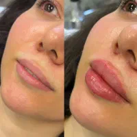 کلینیک زیبایی دکتر حسینی در اقدسیه