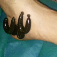 حجامت.زالودرمانی.فصدخون|خدمات آرایشگری و زیبایی|اسلامشهر, شهرک مهدیه|دیوار