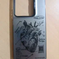 شیامی نوت ۱۴ اس|موبایل|تبریز, |دیوار