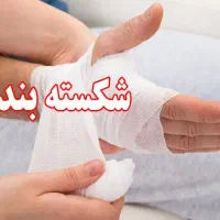 شکسته بندی(سیار)