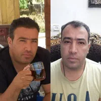کاشت موی طبیعی