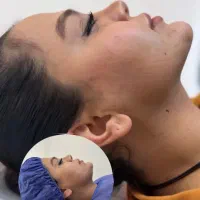 جراحی زیبایی با قیمت فوق العاده مناسب