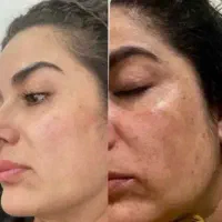 کرمسازی فـرهادی