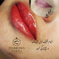 شیدینگ لب/اصلاح تیرگی لب/میکروبلیدینگ/ بندرعباس