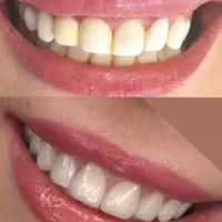 دستیار دندانپزشک باغشاد